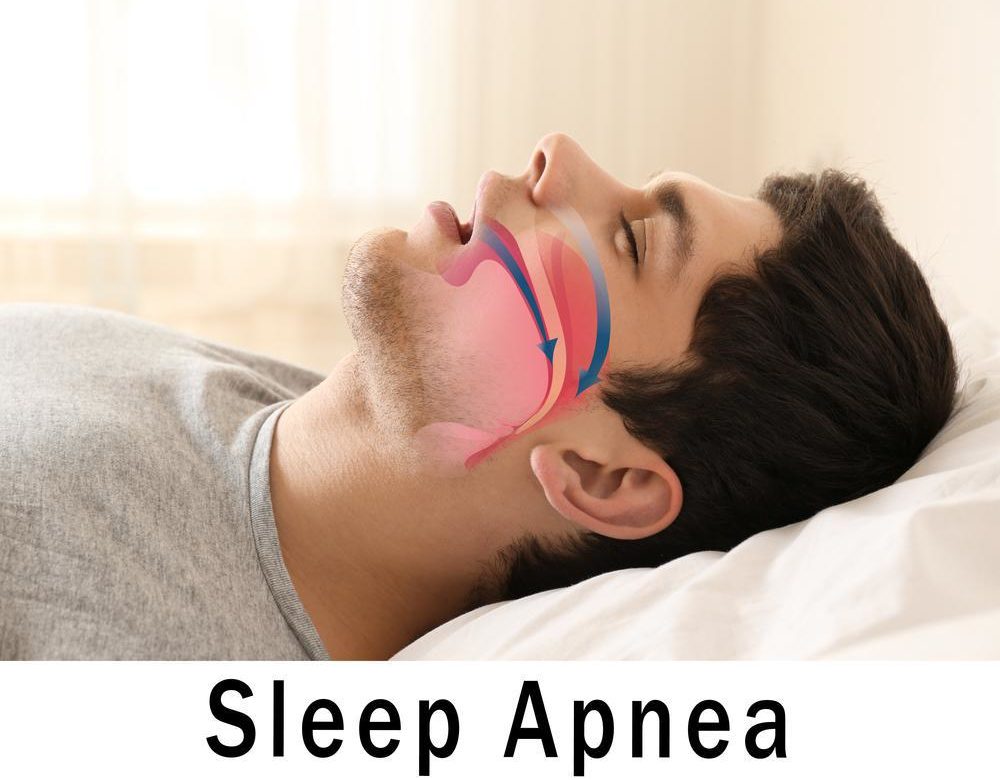 sleep-apnea-raises-your-risk-of-sudden-cardiac-death-get-the-facts